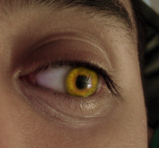 yellow-eye-flickr-photo-sharing