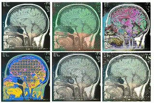 Photo:My Brain on MRI By:CaptPiper