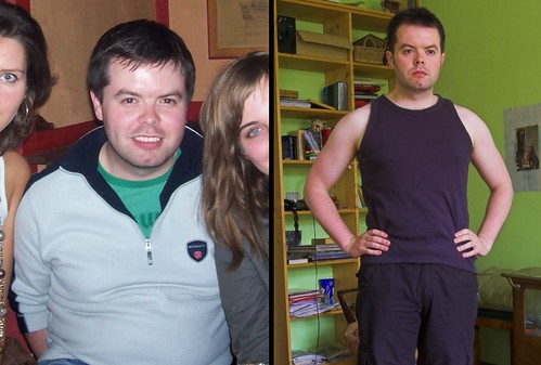 before after weight loss