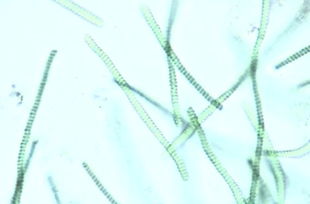 spirulina-microscopy