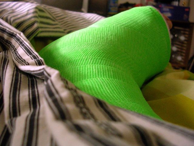 My leg cast again from Flickr via Wylio