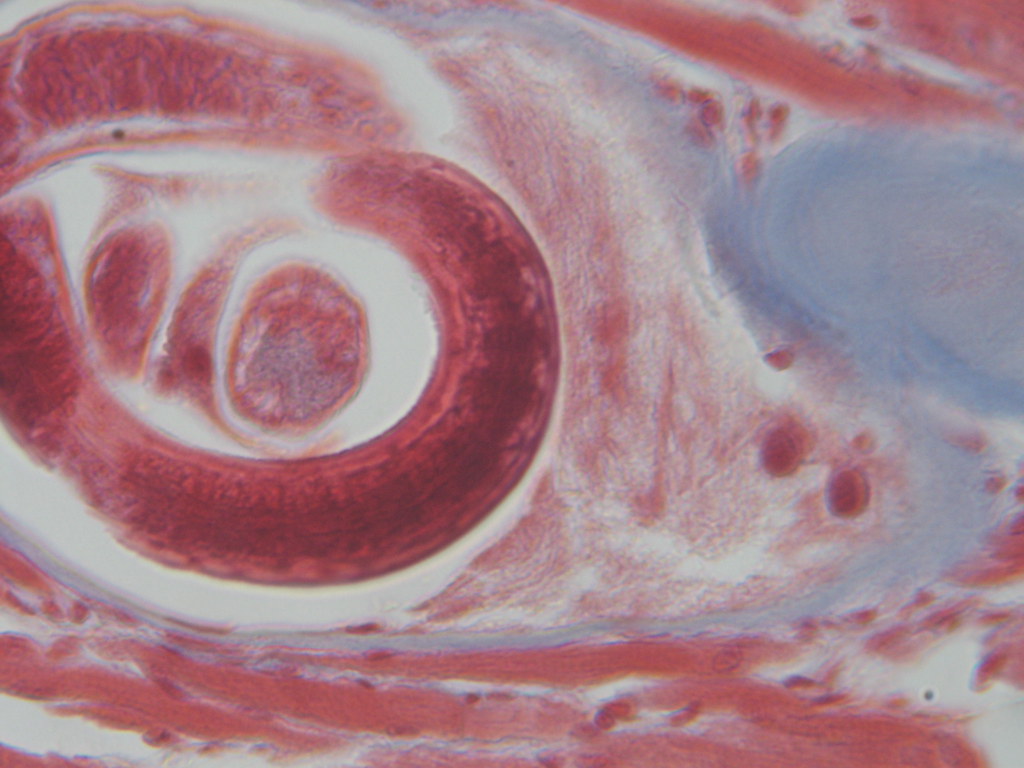 Trichinella Spiralis