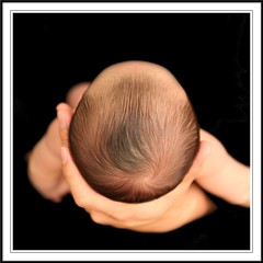 赤ちゃんの後頭部ﾊｹﾞの原因 名誉のハゲ とも言われています