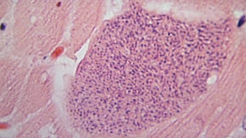 Toxoplazma gondii