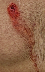 Red mole, Wounded