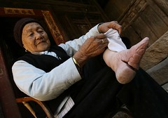 Chinese Bound Feet(5)
