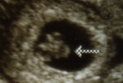 family ultrasound baby2