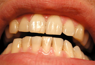 Photo:My Teeth By:Editor B