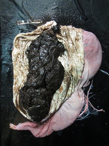 解剖發現胃袋裡滿是塑膠袋。圖片來源：成大鯨豚中心