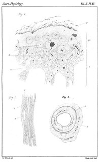Plate XI, Journal of Physiology 2 (5-6) (1880). Figs. 1-3 from De B. Birch, 'The Constitution and Relations of Bone Lamellæ, Lacunæ, and Canaliculi, and some Effects of Trypsin Digestion on Bone'.