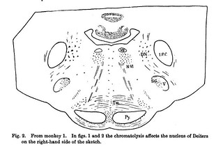 Fig. 2 from R.E. Lloyd, 'On chromatolysis in Deiters' nucleus after hemisection of the cord', Journal of Physiology 25 (3) (1900), pp. 191-195.