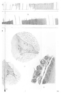 Plate XXI, Journal of Physiology 13 (6) (1892). Figs. 7-15 from C.S. Sherrington, 'Notes on the Arrangement of some Motor Fibres in the Lumbo-Sacral Plexus'.