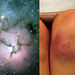 bruise nebula