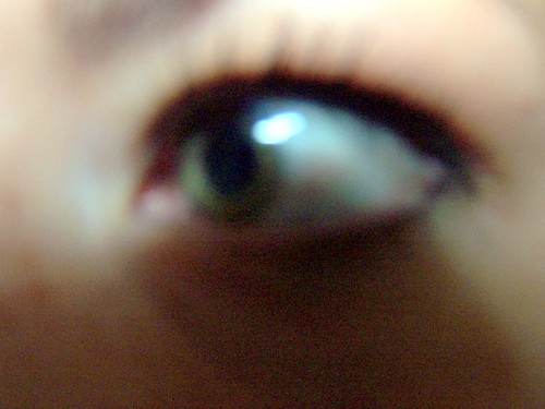 eye II