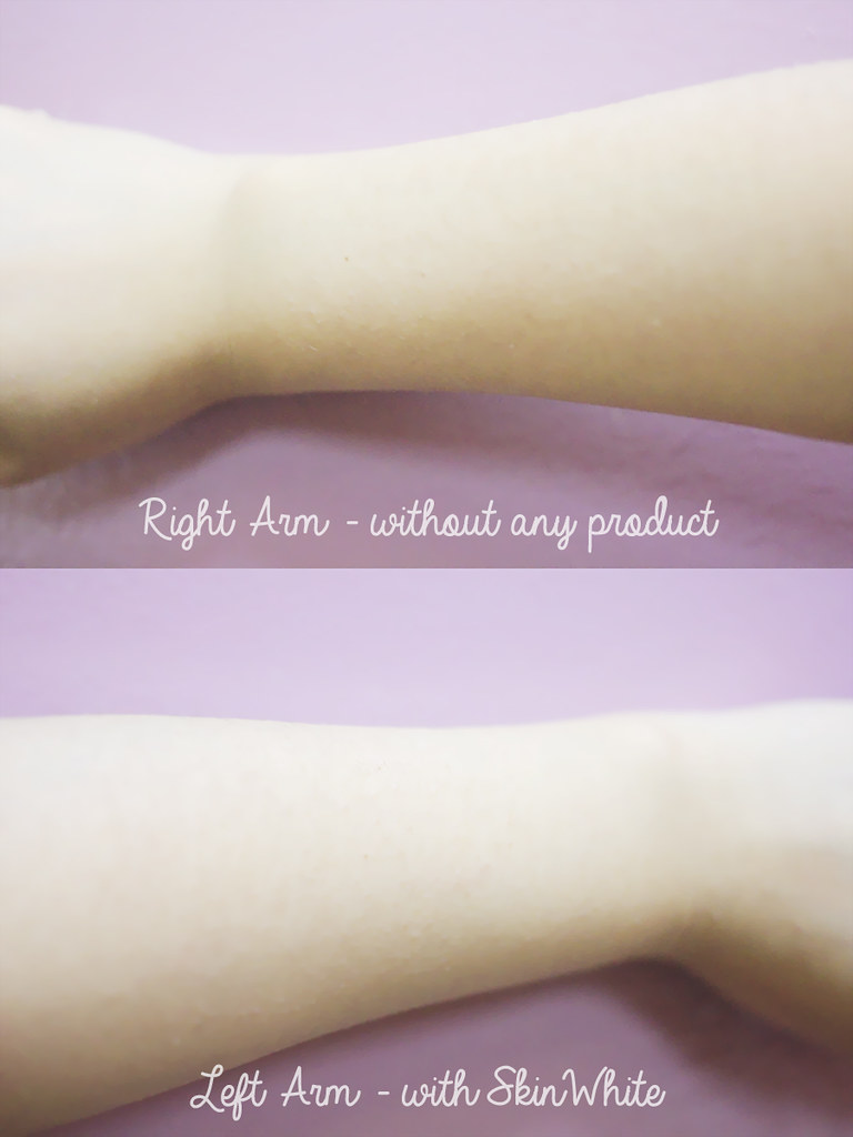 SkinWhite Advanced PowerWhitening Lotion before after