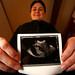 first ultrasound   10 weeks