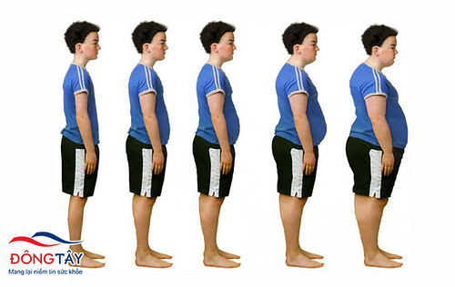 Thay đổi cân nặng thường xuyên ở nam giới làm tăng nguy cơ bệnh sỏi mật