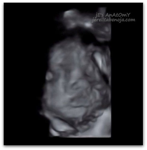 Baby Z 4D Ultrasound
