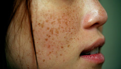 Photo:Freckles By:Frédéric Poirot