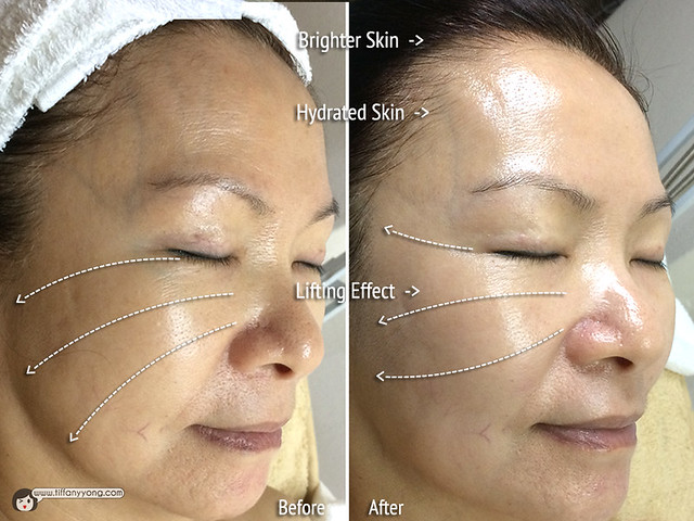 Skin Science Exclusive Treatment Results