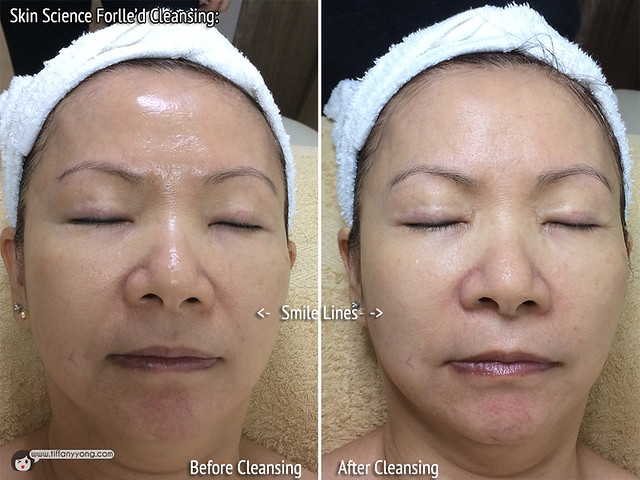 Skin Science Forlled Cleansing