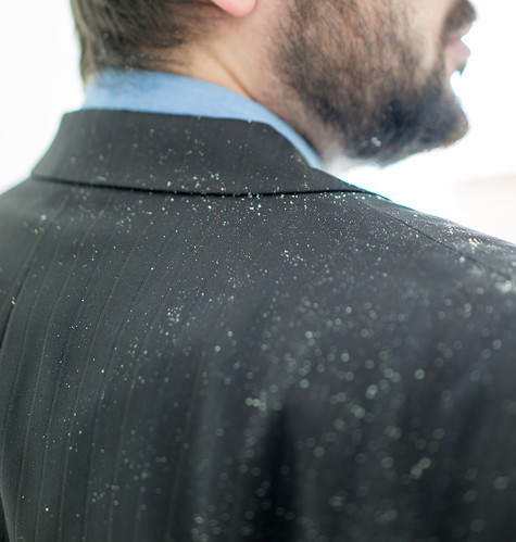 Handle Dandruff Like a Pro with Dr. Joel Schlessinger's Advice