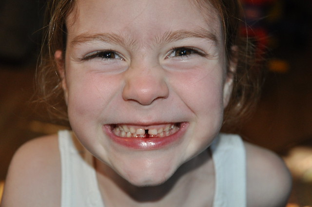 Tooth out. Bloody smile.