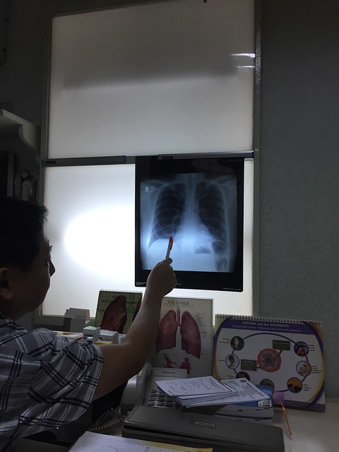 X-ray results, Dr. Franklin Yu