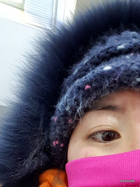  Frozen eyelashes