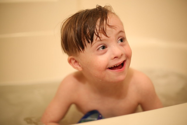 Down syndrome Blog