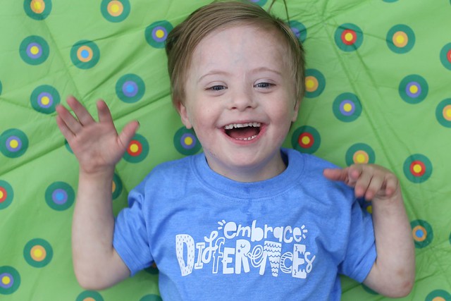 Down syndrome blog