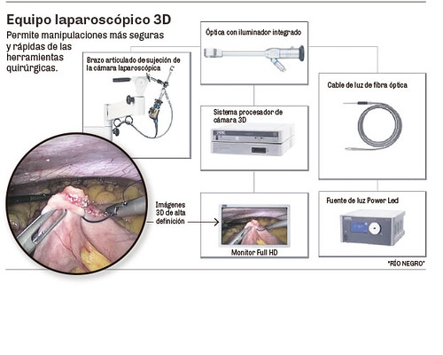 Laparascopio 3D