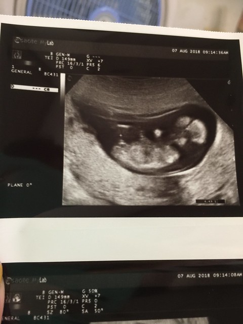 三寶來了 懷孕13 14週 性別出來了 好像被發現突出物了 國與佳的豬窩 Nidbox親子盒子