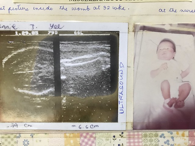 oyen baby photos 026, ultrasound