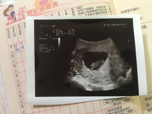 三寶-懷孕9~10週